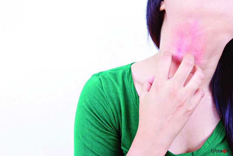 त्वचारोग आणि होमिओपॅथी